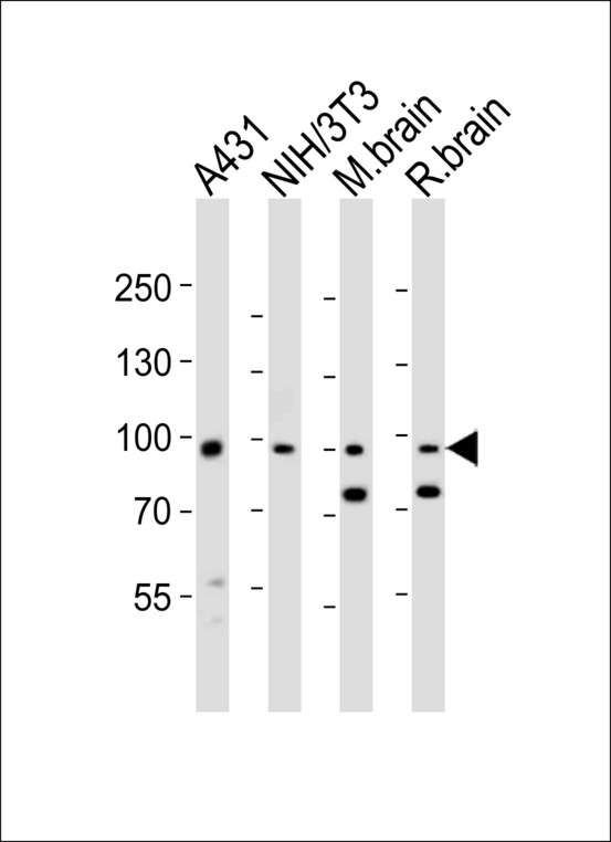 EPHB1 / EPH Receptor B1 Antibody - Western blot of lysates from A431, mouse NIH/3T3 cell line, mouse brain, rat brain tissue lysate (from left to right) with Ephb1 Antibody. Antibody was diluted at 1:1000 at each lane. A goat anti-rabbit IgG H&L (HRP) at 1:10000 dilution was used as the secondary antibody. Lysates at 20 ug per lane.