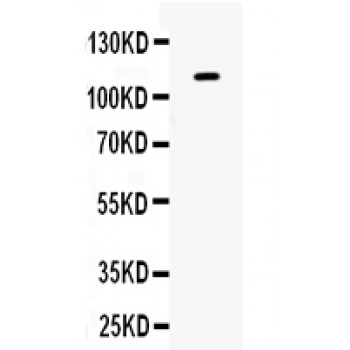 EPHB1 / EPH Receptor B1 Antibody - Eph receptor B1 antibody Western blot. All lanes: Anti Eph receptor B1 at 0.5 ug/ml. WB: 293T Whole Cell Lysate at 40 ug. Predicted band size: 111 kD. Observed band size: 111 kD.