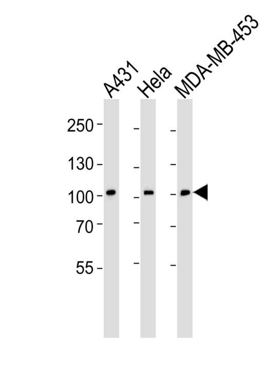 EPHB1 / EPH Receptor B1 Antibody - Western blot of lysates from A431, HeLa, MDA-MB-453 cell line (from left to right), using EPHB1 Antibody (H970). Antibody was diluted at 1:1000 at each lane. A goat anti-rabbit IgG H&L (HRP) at 1:5000 dilution was used as the secondary antibody. Lysates at 35ug per lane.