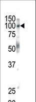 EPHB1 / EPH Receptor B1 Antibody - Western blot of anti-EphB1 antibody in mouse brain tissue. EphB1 (arrow) was detected using purified antibody. Secondary HRP-anti-rabbit was used for signal visualization with chemiluminescence.