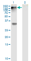 EPHB1 / EPH Receptor B1 Antibody - Western Blot analysis of EPHB1 expression in transfected 293T cell line by EPHB1 monoclonal antibody (M01), clone 4G6.Lane 1: EPHB1 transfected lysate (Predicted MW: 109.9 KDa).Lane 2: Non-transfected lysate.