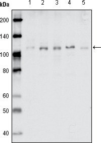 EPHB1 / EPH Receptor B1 Antibody - Western blot using EhpB1 mouse monoclonal antibody against MDA-MB-468 (1), MDA-MB-453 (2), MCF-7 (3), T47D (4) and SKBR-3 (5) cell lysate.