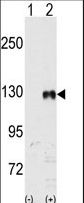 EPHB1 / EPH Receptor B1 Antibody - Western blot of EphB1 (arrow) using rabbit polyclonal EphB1 Antibody 293 cell lysates (2 ug/lane) either nontransfected (Lane 1) or transiently transfected with the EphB1 gene (Lane 2) (Origene Technologies).