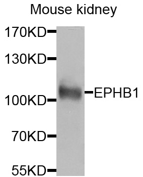 EPHB1 / EPH Receptor B1 Antibody - Western blot analysis of extracts of mouse kidney cells .