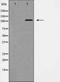 EPHB1 / EPH Receptor B1 Antibody - Western blot analysis of EPHB1 expression in COS7 cells. The lane on the left is treated with the antigen-specific peptide.