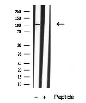 EPHB1 / EPH Receptor B1 Antibody - Western blot analysis of EPH B1/3/4 in lysates of NIH 3T3 cells using EPH B1/3/4 antibody.