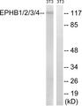 EPHB1 + EPHB2 + EPHB3 + EPHB4 Antibody - Western blot analysis of extracts from 3T3 cells, treated with heat shock, using EPHB1/2/3/4 (Ab-600/602/614/596) antibody.