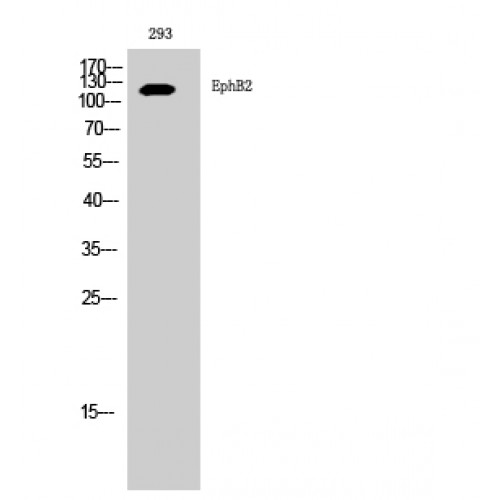 EPHB2 / EPH Receptor B2 Antibody - Western blot of EphB2 antibody