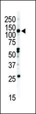 EPHB2 / EPH Receptor B2 Antibody - Western blot of anti-EphB2 C-term antibody in NCI-H460 cell lysate. EphB2 (arrow) was detected using purified antibody. Secondary HRP-anti-rabbit was used for signal visualization with chemiluminescence.