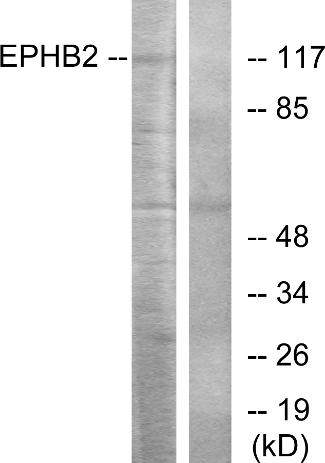 EPHB2 / EPH Receptor B2 Antibody - Western blot analysis of lysates from Jurkat cells, using EPHB2 Antibody. The lane on the right is blocked with the synthesized peptide.