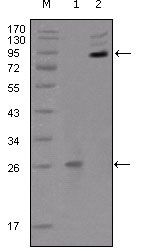 EPHB2 / EPH Receptor B2 Antibody - EphB2 Antibody in Western Blot (WB)