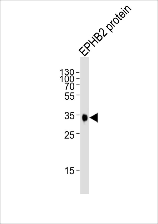 EPHB2 / EPH Receptor B2 Antibody - Western blot of lysate from EPHB2 protein, using EphB2 Antibody. Antibody was diluted at 1:1000. A goat anti-mouse IgG H&L (HRP) at 1:3000 dilution was used as the secondary antibody. Lysate at 35ug.