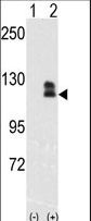 EPHB2 / EPH Receptor B2 Antibody - Western blot of EphB2(arrow) using rabbit polyclonal EphB2 Antibody. 293 cell lysates (2 ug/lane) either nontransfected (Lane 1) or transiently transfected with the EphB2 gene (Lane 2) (Origene Technologies).