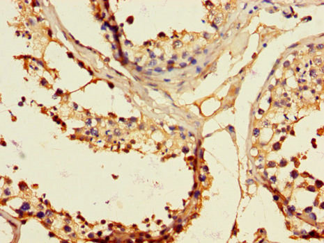 EPHB2 / EPH Receptor B2 Antibody - Immunohistochemistry of paraffin-embedded human testicular tissue using EPHB2 Antibody at dilution of 1:100