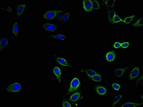 EPHB2 / EPH Receptor B2 Antibody - Immunofluorescent analysis of Hela cells using EPHB2 Antibody at a dilution of 1:100 and Alexa Fluor 488-congugated AffiniPure Goat Anti-Rabbit IgG(H+L)