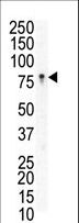 EPHB3 / EPH Receptor B3 Antibody - Western blot of anti-EphB3 N-term antibody in Jurkat cell lysate. EphB3 (arrow) was detected using purified antibody. Secondary HRP-anti-rabbit was used for signal visualization with chemiluminescence.