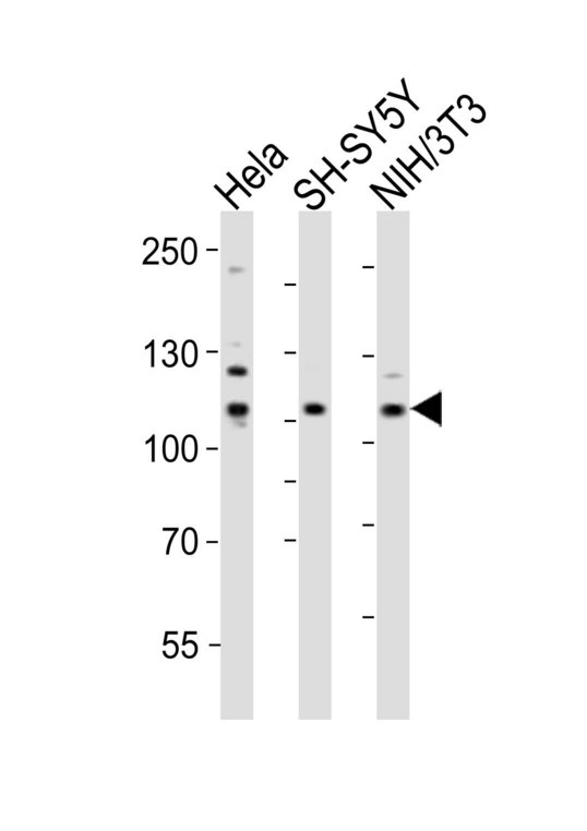EPHB3 / EPH Receptor B3 Antibody - Western blot of lysates from HeLa. SH-SY5Y, mouse NIH/3T3 cell line (from left to right) with Ephb3 Antibody. Antibody was diluted at 1:1000 at each lane. A goat anti-rabbit IgG H&L (HRP) at 1:10000 dilution was used as the secondary antibody. Lysates at 20 ug per lane.