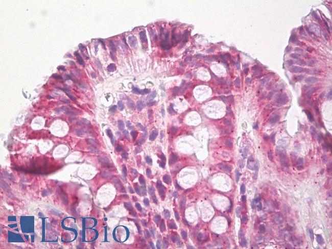 EPHB3 / EPH Receptor B3 Antibody - Anti-EPHB3 antibody IHC of human colon, epithelium. Immunohistochemistry of formalin-fixed, paraffin-embedded tissue after heat-induced antigen retrieval. Antibody dilution 5-10 ug/ml. This image was taken for the unconjugated form of this product. Other forms have not been tested.