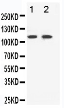 EPHB3 / EPH Receptor B3 Antibody - WB of EPHB3 / EPH Receptor B3 antibody. All lanes: Anti-EPHB3 at 0.5ug/ml. Lane 1: HELA Whole Cell Lysate at 40ug. Lane 2: A549 Whole Cell Lysate at 40ug. Predicted bind size: 110KD. Observed bind size: 110KD.