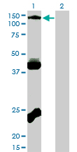 EPHB3 / EPH Receptor B3 Antibody - Western blot of EPHB3 expression in transfected 293T cell line by EPHB3 monoclonal antibody (M01), clone 1B3.