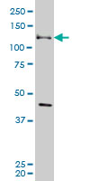 EPHB3 / EPH Receptor B3 Antibody - EPHB3 monoclonal antibody (M08), clone 4E9 Western blot of EPHB3 expression in A-431.
