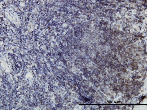 EPHB3 / EPH Receptor B3 Antibody - Immunoperoxidase of monoclonal antibody to EPHB3 on formalin-fixed paraffin-embedded human lymph node. [antibody concentration 3 ug/ml]