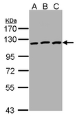 EPHB3 / EPH Receptor B3 Antibody - Sample(30g of whole cell lysate). A: HeLa. B: Hep G2. C: MOLT-4. 7.5% SDS PAGE. EPHB3 antibody diluted at 1:1000