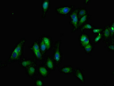 EPHB3 / EPH Receptor B3 Antibody - Immunofluorescent analysis of Hela cells at a dilution of 1:100 and Alexa Fluor 488-congugated AffiniPure Goat Anti-Rabbit IgG(H+L)