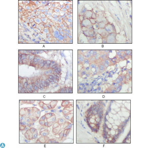 EPHB3 / EPH Receptor B3 Antibody - Western Blot (WB) analysis using EphB3 Monoclonal Antibody against truncated EphB3-His recombinant protein.