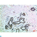 EPHB3 / EPH Receptor B3 Antibody - Immunohistochemical analysis of paraffin-embedded Human-breast, antibody was diluted at 1:100.