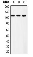 EPHB3 / EPH Receptor B3 Antibody - Western blot analysis of EPHB3 (pY608) expression in HeLa (A); NIH3T3 (B); PC12 (C) whole cell lysates.