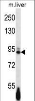 EPHB4 / EPH Receptor B4 Antibody - Mouse Ephb4 Antibody western blot of mouse liver tissue lysates (35 ug/lane). The Ephb4 antibody detected the Ephb4 protein (arrow).