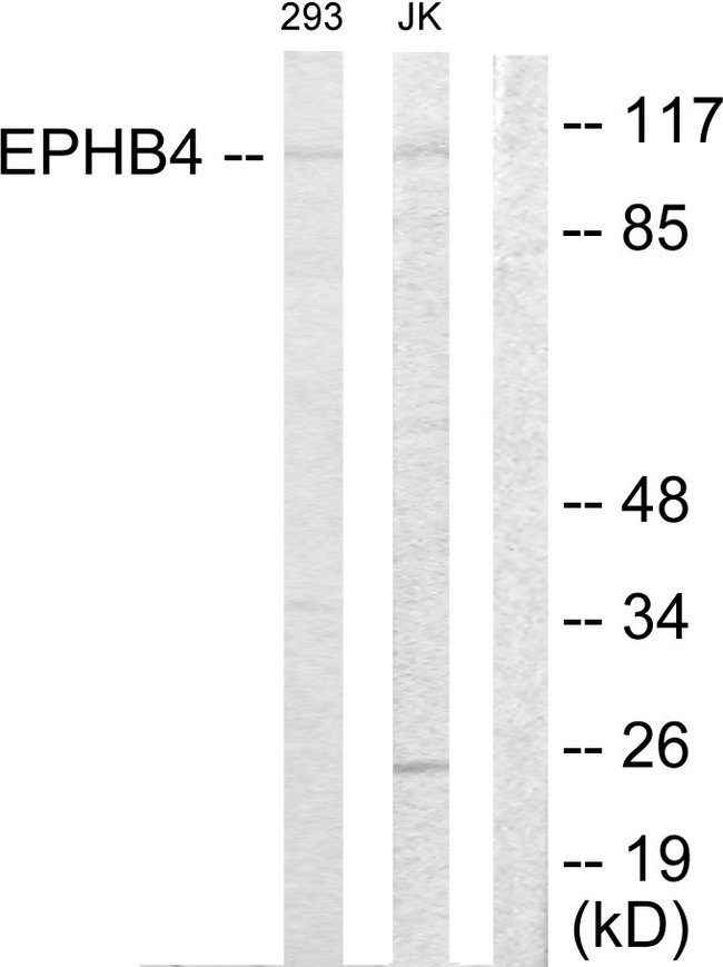 EPHB4 / EPH Receptor B4 Antibody - Western blot analysis of lysates from Jurkat and 293 cells, using EPHB4 Antibody. The lane on the right is blocked with the synthesized peptide.