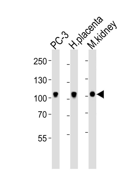 EPHB4 / EPH Receptor B4 Antibody - Western blot of lysates from PC-3 cell line, human placenta, mouse kidney tissue lysate (from left to right) with Ephb4 Antibody. Antibody was diluted at 1:1000 at each lane. A goat anti-rabbit IgG H&L (HRP) at 1:10000 dilution was used as the secondary antibody. Lysates at 20 ug per lane.
