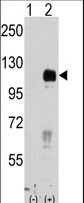 EPHB4 / EPH Receptor B4 Antibody - Western blot of EphB4 (arrow) using rabbit polyclonal EphB4 Antibody. 293 cell lysates (2 ug/lane) either nontransfected (Lane 1) or transiently transfected with the EphB4 gene (Lane 2) (Origene Technologies).