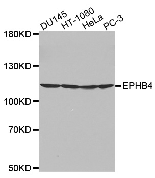 EPHB4 / EPH Receptor B4 Antibody - Western blot analysis of extracts of various cell lines, using EPHB4 antibody.