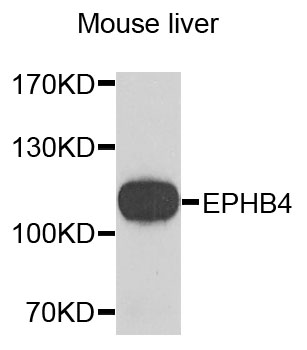 EPHB4 / EPH Receptor B4 Antibody - Western blot analysis of extracts of mouse liver cells.