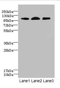 EPHB4 / EPH Receptor B4 Antibody - Western blot All Lanes: EPHB4 antibody at 2.71ug/ml Lane 1: A549 whole cell lysate Lane 2: 293T whole cell lysate Lane 3: Hela whole cell lysate Secondary Goat polyclonal to rabbit IgG at 1/10000 dilution Predicted band size: 109,56,34,46 kDa Observed band size: 108 kDa