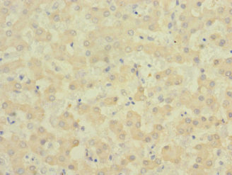 EPHB4 / EPH Receptor B4 Antibody - Immunohistochemistry of paraffin-embedded human liver tissue at dilution 1:100