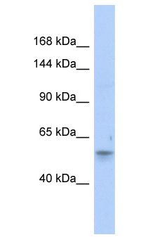 EPHB6 / EPH Receptor B6 Antibody - HEP / EPHB6 antibody Western Blot of HepG2. Antibody dilution: 1 ug/ml.  This image was taken for the unconjugated form of this product. Other forms have not been tested.
