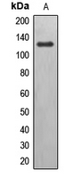 EPHB6 / EPH Receptor B6 Antibody - Western blot analysis of EPHB6 expression in Jurkat (A) whole cell lysates.