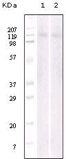EPHB6 / EPH Receptor B6 Antibody - Western blot of Jurkat (1) and NIH/3T3 (2) cell lysate using EphB6 mouse mAb.