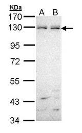 EPHB6 / EPH Receptor B6 Antibody - Sample (30 ug of whole cell lysate). A: H1299. A: Hela. 7.5% SDS PAGE. EPHB6 antibody diluted at 1:1000. 