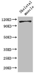 EPHB6 / EPH Receptor B6 Antibody - Positive WB detected in:Mouse skeletal muscle tissue;All lanes: EPHB6 antibody at 2ug/ml;Secondary;Goat polyclonal to rabbit IgG at 1/50000 dilution;Predicted band size: 111,82,58 kDa;Observed band size: 111 kDa;