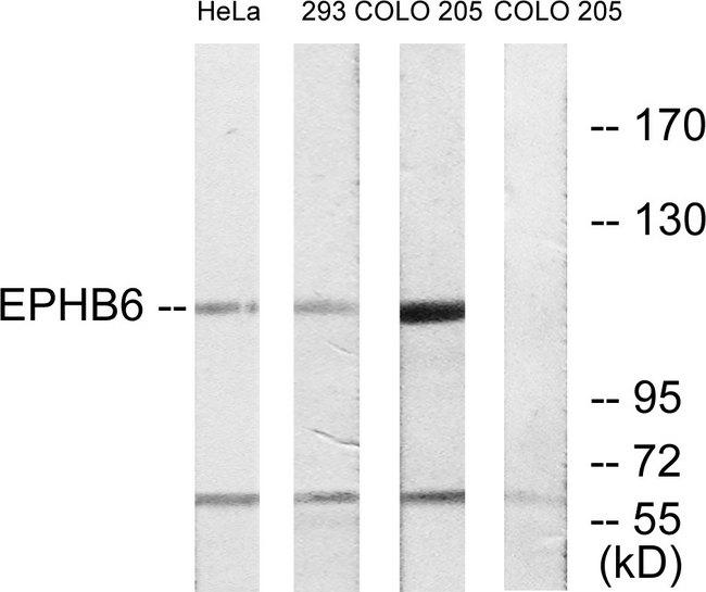 EPHB6 / EPH Receptor B6 Antibody - Western blot analysis of extracts from HeLa cells, 293 cells and COLO cells, using EPHB6 antibody.