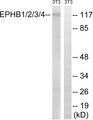 Ephrin B, pan Antibody - Western blot analysis of lysates from NIH/3T3 cells, treated with heat shock, using EPHB1/2/3/4 Antibody. The lane on the right is blocked with the synthesized peptide.
