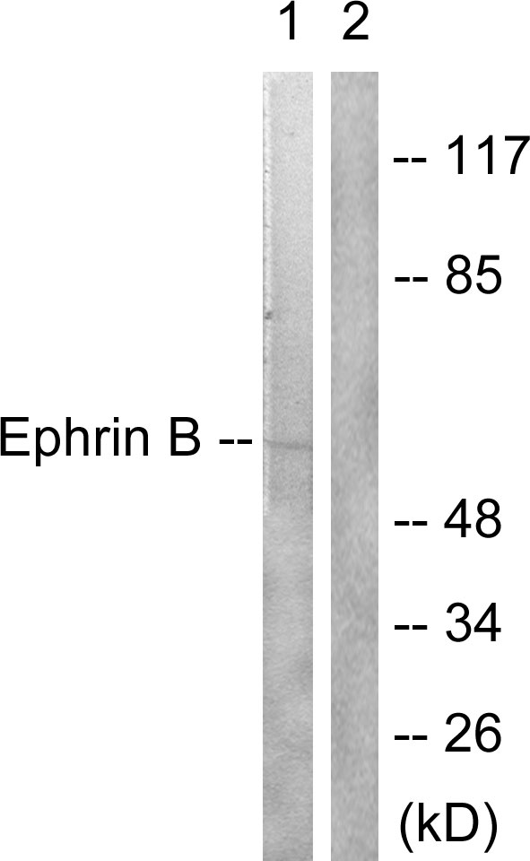 Ephrin B1+B2 Antibody - Western blot analysis of lysates from 293 cells, treated with EGF 200ng/ml 5', using EFNB1/2 Antibody. The lane on the right is blocked with the synthesized peptide.