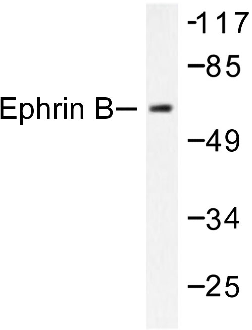 Ephrin B1+B2 Antibody - Western blot of Ephrin-B (Q324) pAb in extracts from 293 cells treated with EGF 200ng/ml 5' or 293 cells treated with TNF-a 20ng/ml 30'.