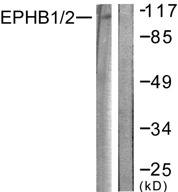 Ephrin B1+B2 Antibody - Western blot analysis of extracts from HepG2 cells, using EPHB1/2 (Ab-594/604) antibody.