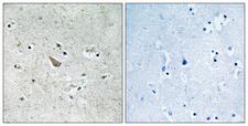 Ephrin B1+B2 Antibody - Immunohistochemistry analysis of paraffin-embedded human brain, using Ephrin B1/B2 (Phospho-Tyr329) Antibody. The picture on the right is blocked with the phospho peptide.